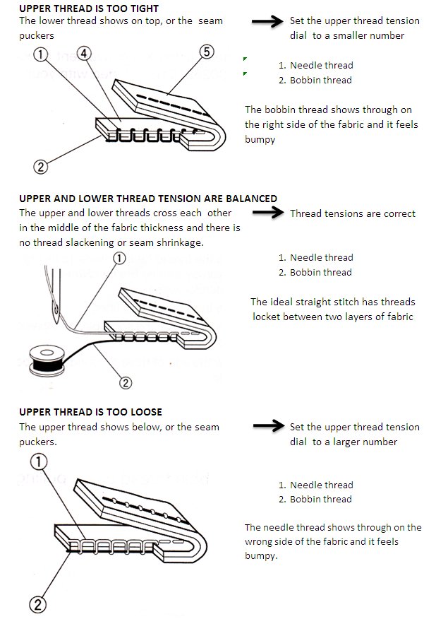 Image of tension1.jpg